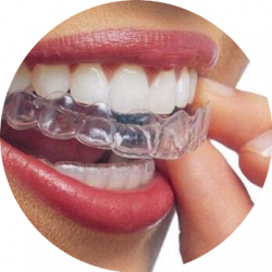clinica dentale smile garden clinic allineatori dentali